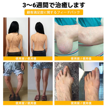 ZUWIAY® ハチ毒配合 痛み緩和・関節ケア・骨サポートクリーム 🎊🎊（膝・腰・肩・手首など全身ケア／中高年の方の運動の柔軟性と日常の快適さをサポート）