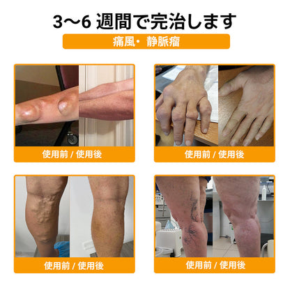 ZUWIAY® ハチ毒配合 痛み緩和・関節ケア・骨サポートクリーム 🎊🎊（膝・腰・肩・手首など全身ケア／中高年の方の運動の柔軟性と日常の快適さをサポート）